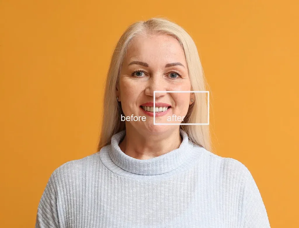 Ways to Upgrade Your Teeth With a Smile Makeover